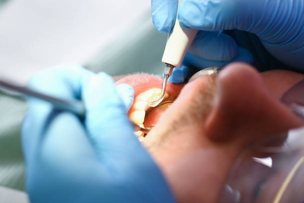 Best Knocked-Out Tooth Emergency  in Elmwood, IL