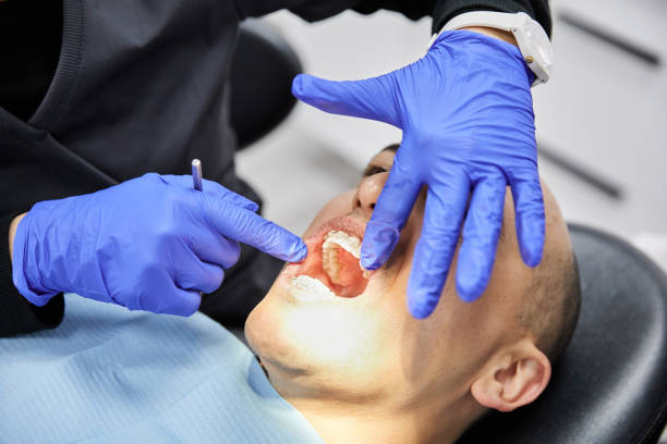 Best Emergency Gum Pain Relief  in Elmwood, IL